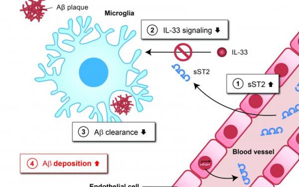 The diagram shows how increased sST2 levels in AD impair microglial clearance of amyloid pathology: increased levels of sST2 protein (1) in the blood enter the brain; this decoy receptor blocks the normal signaling stimulated by IL-33 in microglia (2). The inhibition of IL-33 signaling leads to reduced clearance of Aβ by microglia (3), resulting in an increase in Aβ plaque load (4).