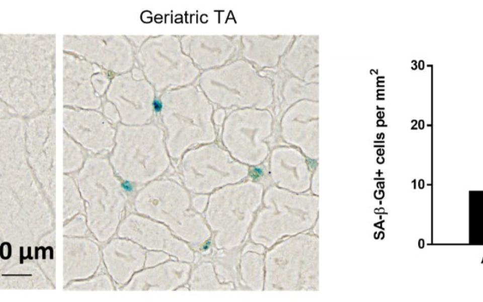 Figure 1: Injured geriatric muscle shows increased signs of senescence. Adult and geriatric Tibialis anterior (TA) muscle was injured and was stained for the presence of the senescence marker, SA-β-gal (seen as a blue stain, left). Geriatric TA muscles showed an increased percentage of SA-β-gal positive cells compared to their younger counterparts (right).