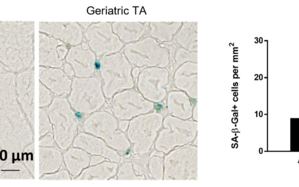 圖1：受傷的老年肌肉顯示出衰老跡象增加。受損的成年和老年脛骨前肌會因衰老標誌物SA-β-gal的存在而被染色（左圖顯示為藍色染色）。與成年的對照組相比，老年脛骨前肌中SA-β-gal陽性細胞的百分比增加（右圖）。