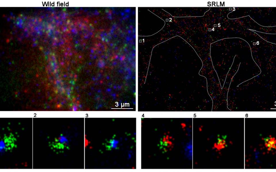  Images taken by HKUST’s SRLM microscope (upper right – break down to 1-6) are much sharper than those by regular ones (upper left), allowing researchers to discover for the first time that ATM (blue) and ATR (red) were never found on the same synaptic vesicle (green).