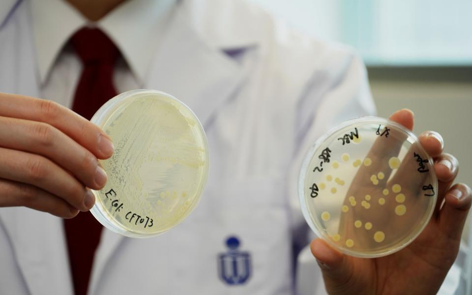 The dish on the left is the E. Coli cloned by the research team