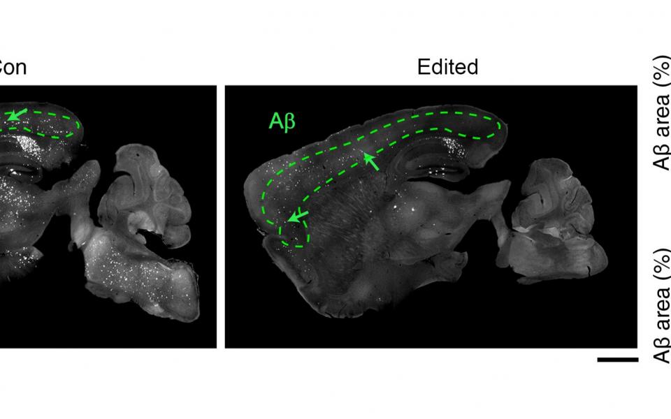 The level of amyloid (white shades in area encircled by green dotted lines) - the protein thought to drive neurodegeneration in AD, is high in the brain of AD mouse (left) and reduces after the administration of the genome editing therapy throughout the brain (right).